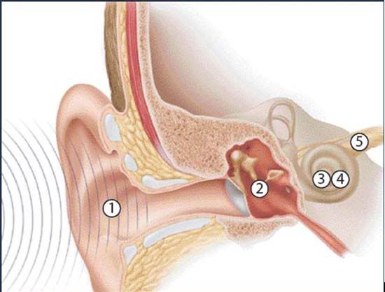 tinnitus retraining therapy